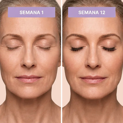 Sérum para Pestañas Velmadora™ – Pestañas Más Largas, Densas y Fuertes